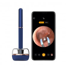 Умный очиститель для ушей Xiaomi Bebird Note 3 Pro Max